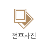 전후사진